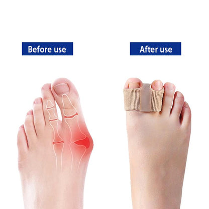 ZenToes — Bunion Correctors & Toe Spacers